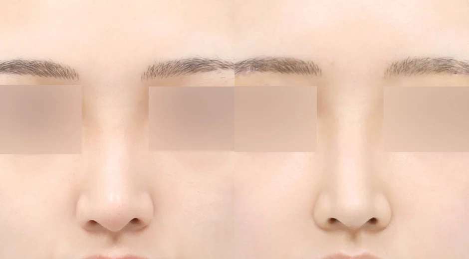 bannerImage
