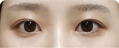 Trước
