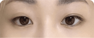 Trước