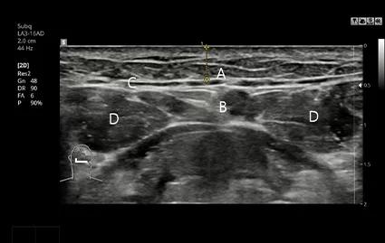 Ảnh CT trước phẫu thuật