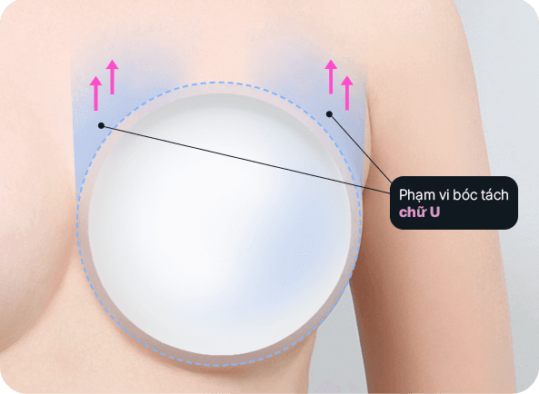 Ab Surgery