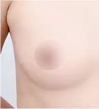 Trước phẫu thuật