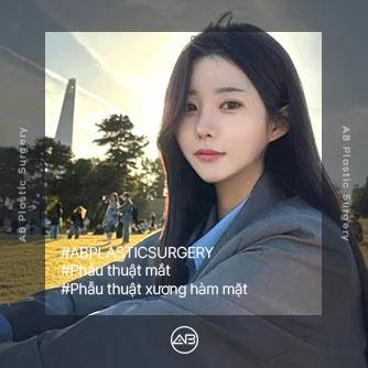 Phẫu thuật mắt
Phẫu thuật xương hàm mặt