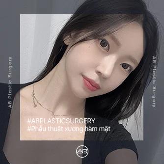 Phẫu thuật xương hàm mặt