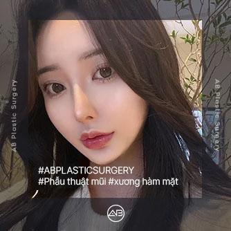 Phẫu thuật mũi, xương hàm mặt
