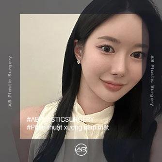 Phẫu thuật xương hàm mặt