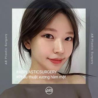 Phẫu thuật xương hàm mặt