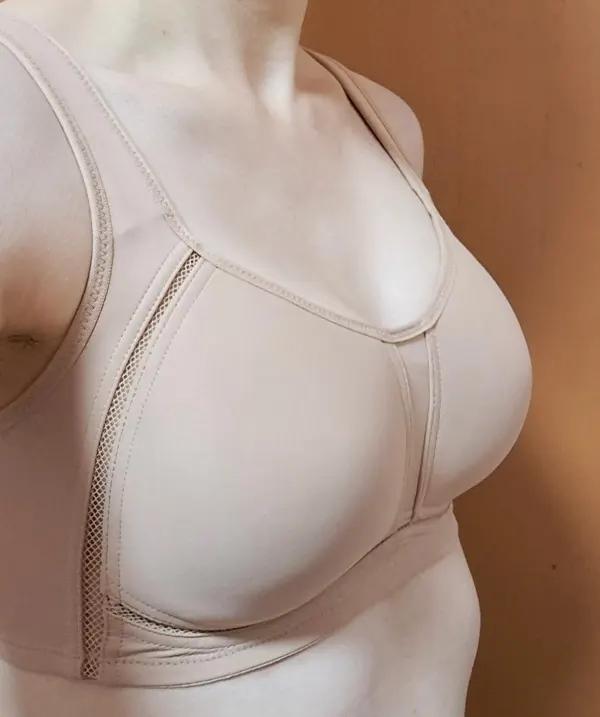 Before and after surgery front view