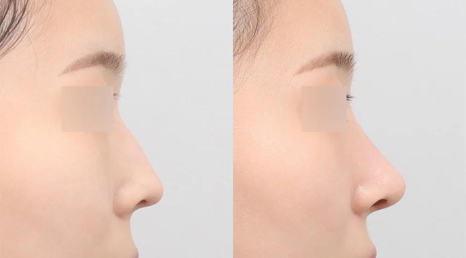 AB Plastic Surgery