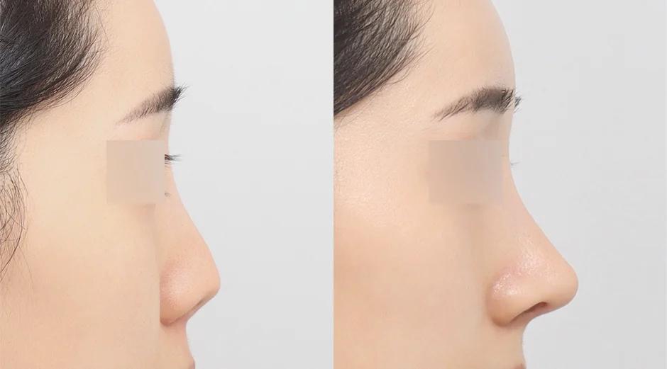 AB Plastic Surgery