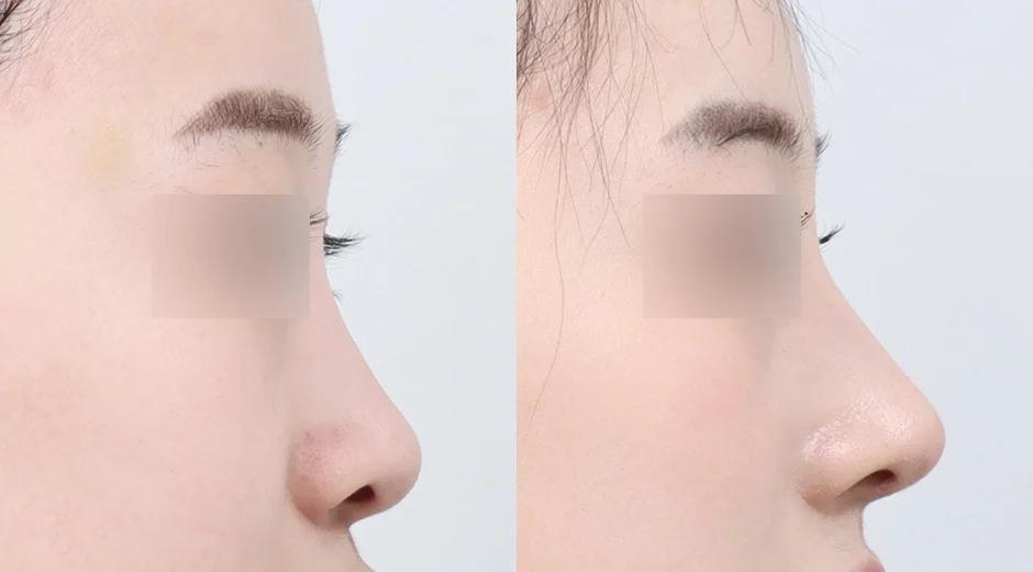 AB Plastic Surgery