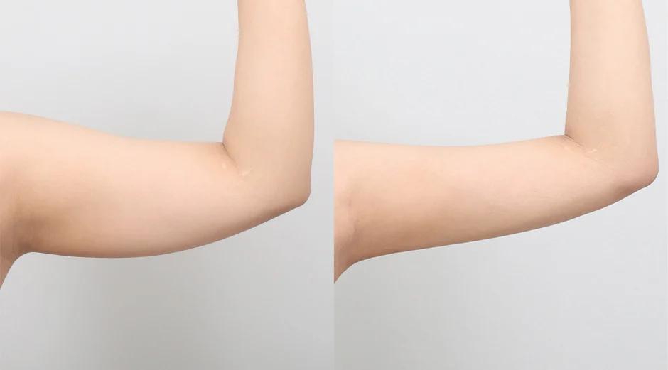 AB Plastic Surgery