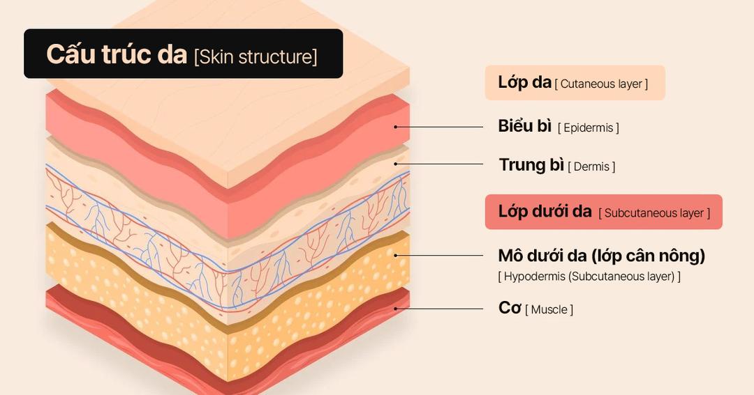 TopListSlide