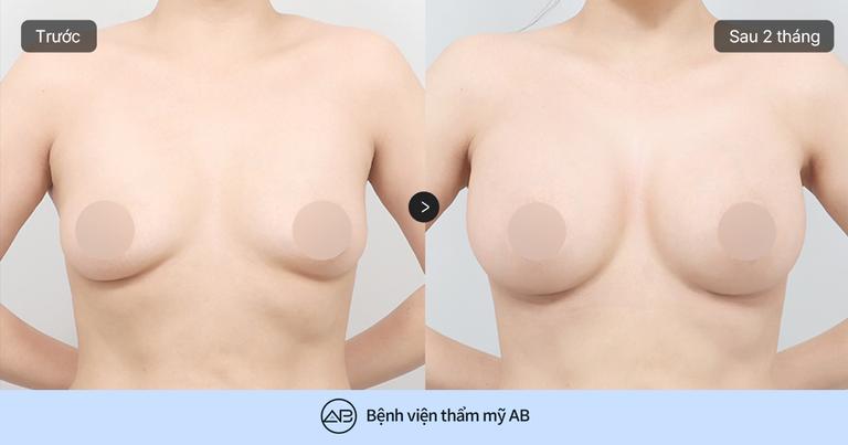 Phẫu thuật thẩm mỹ AB