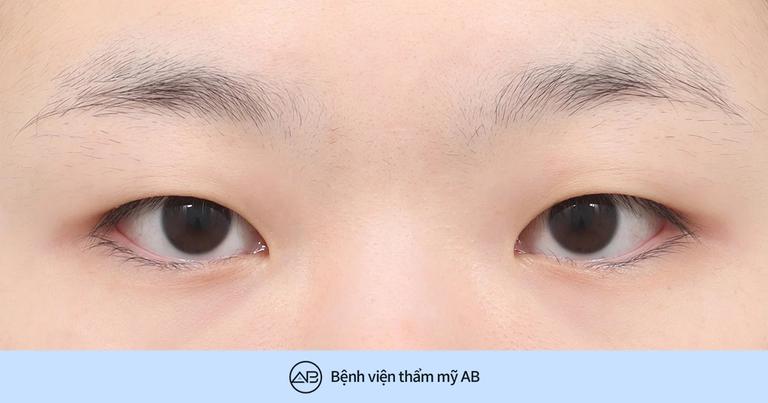 Phẫu thuật thẩm mỹ AB