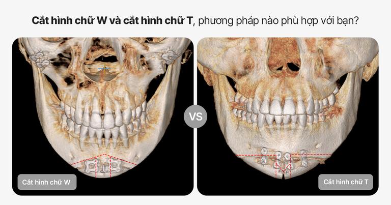 Phẫu thuật thẩm mỹ AB
