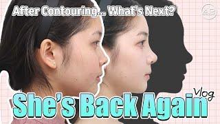 [phẫu thuật thẩm mỹ Hàn Quốc] Phẫu thuật nâng mũi tại Hàn Quốc [Part 1]