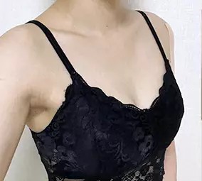 Trước phẫu thuật