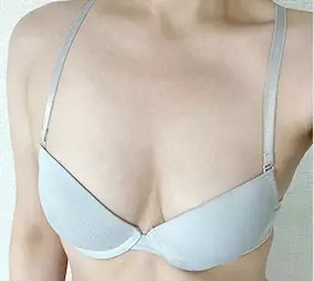 Trước phẫu thuật