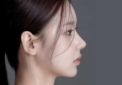 Phẫu thuật mũi AB, bắt đầu từ dáng mũi
đẹp tự nhiên và lộng lẫy