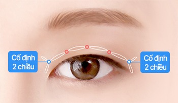 Phương pháp phẫu thuật nhấn mí đẹp tự nhiên và lộng lẫy step 02