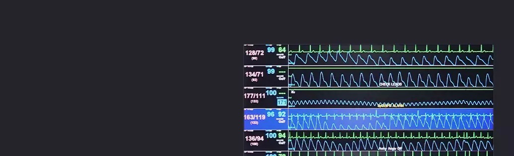 Central Monitoring System Monitor Screen