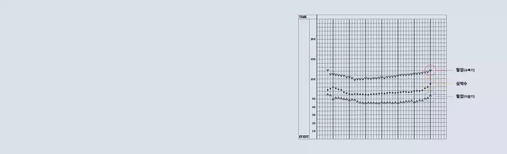 Real Time Anesthesia Records Graph