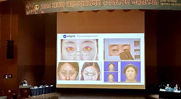 Hoạt động báo cáo khoa học và công bố nghiên cứu 
tại các hội nghị trong và ngoài nướcHội nghiên cứu phẫu thuật mắt APS
và các hội thảo học thuật chuyên ngành mắt
