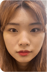 facial after