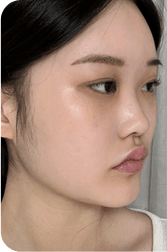 facial after