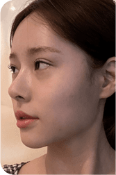 facial after