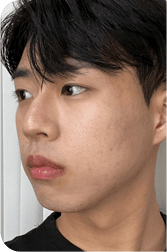 facial after