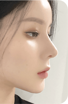 nose before