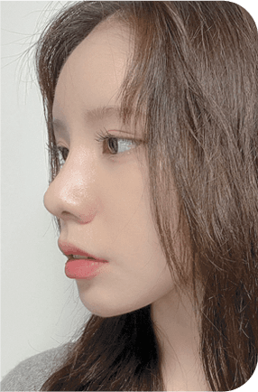 nose before