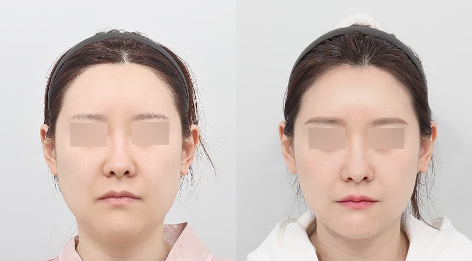 AB Plastic Surgery