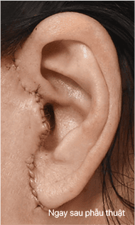 Skill matters in post-surgery scarring too. 2