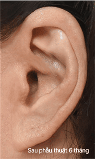 Skill matters in post-surgery scarring too. 3