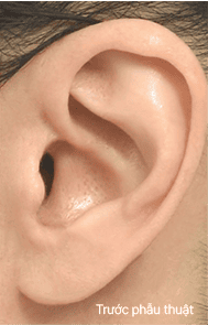 Skill matters in post-surgery scarring too. 1