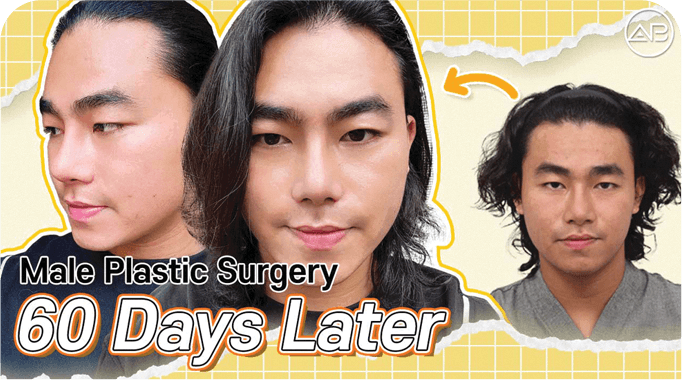 AB plastic surgery