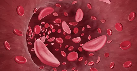 Tiêm tế bào gốc máu