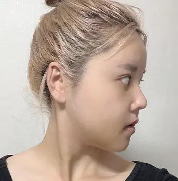 Sau 12 ngày