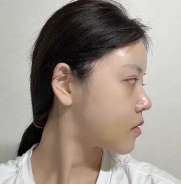 Sau 14 ngày