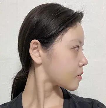 Sau 4 tuần