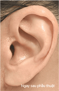 Skill matters in post-surgery scarring too. 2