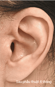 Skill matters in post-surgery scarring too. 3