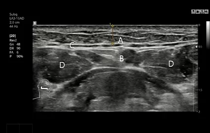 Ảnh CT trước phẫu thuật