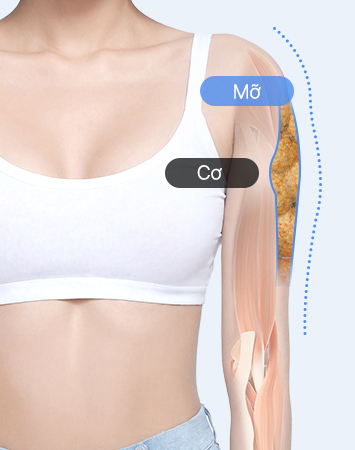 Fat and muscle before precise diagnosis