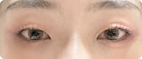 beforeAfter