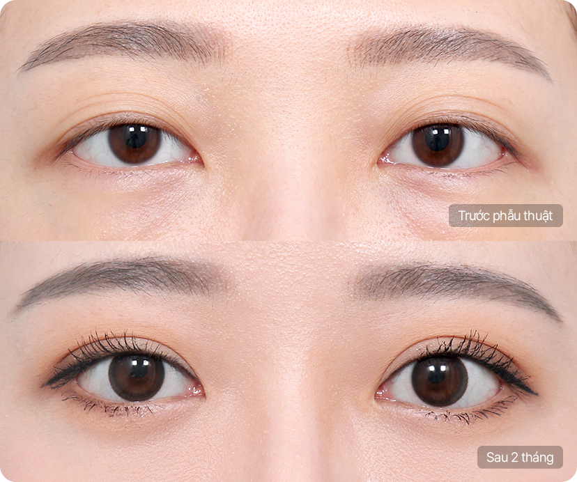 AB Plastic Surgery