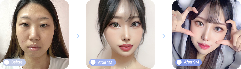 AB plastic surgery